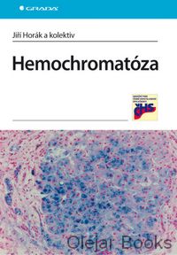 Hemochromatóza