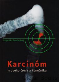 Karcinóm hrubého čreva a konečníka
