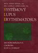 Systémový lupus erythematosus